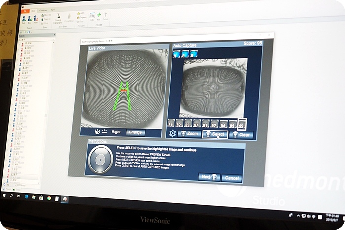 ▋角膜塑型片 ▋兒童權威 EyePlus 聚英視光眼科。矯正視力So Easy。夜晚配戴，還你白天好視力！ @捲捲頭 ♡ 品味生活